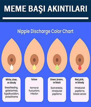 Meme Başı Akıntıları